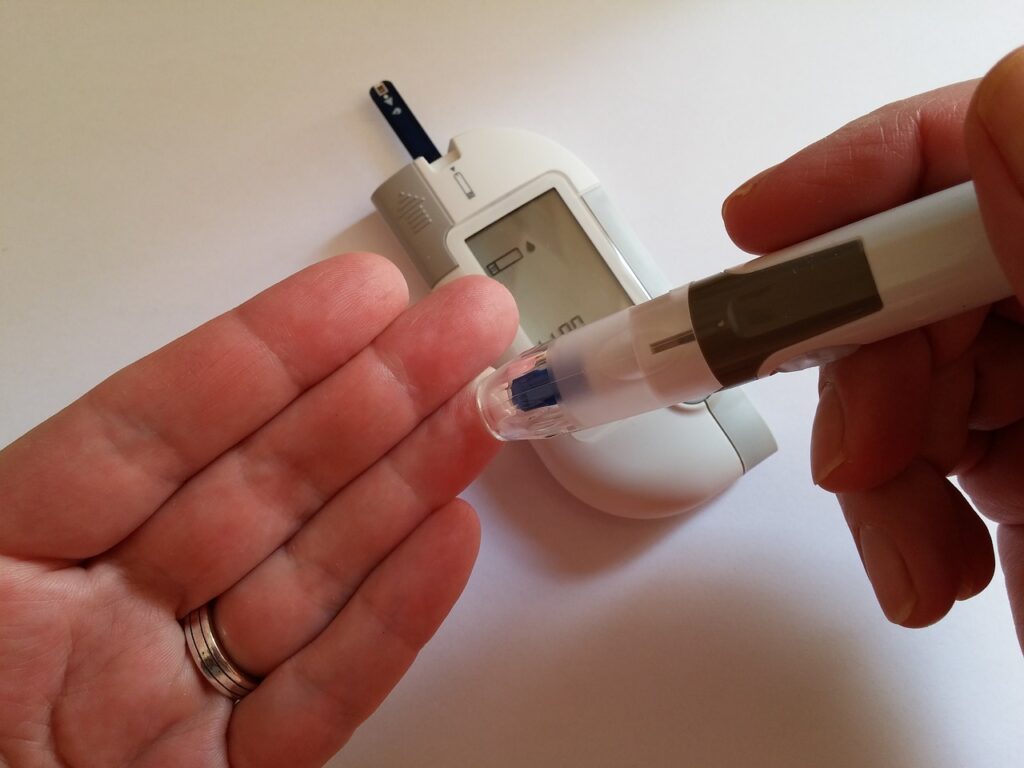 Cirurgia do diabetes: Técnicas indicadas - Instituto de Medicina Sallet