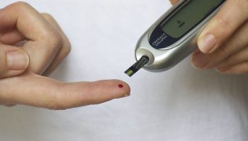 O que é cirurgia metabólica?
