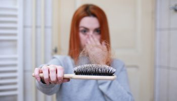 Queda de Cabelo após Cirurgia Bariátrica: causas e tratamento